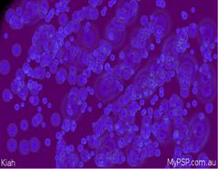 Abstract - Blue Bubbles!